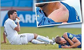 Luis Suarez committed his third biting offence during his career by chomping on Italy's Georgio Chiellini 